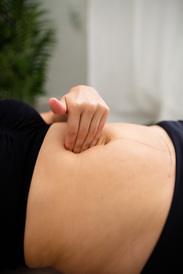 how to tell if you have diastasis recti demonstration